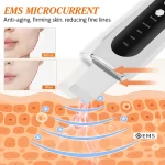 Ultrasonic Face Skin Scrubber Vibration Nose Deep Cleaning Machine   Facial Spatula Blackhead Remover Peeling Shovel Pore Clean